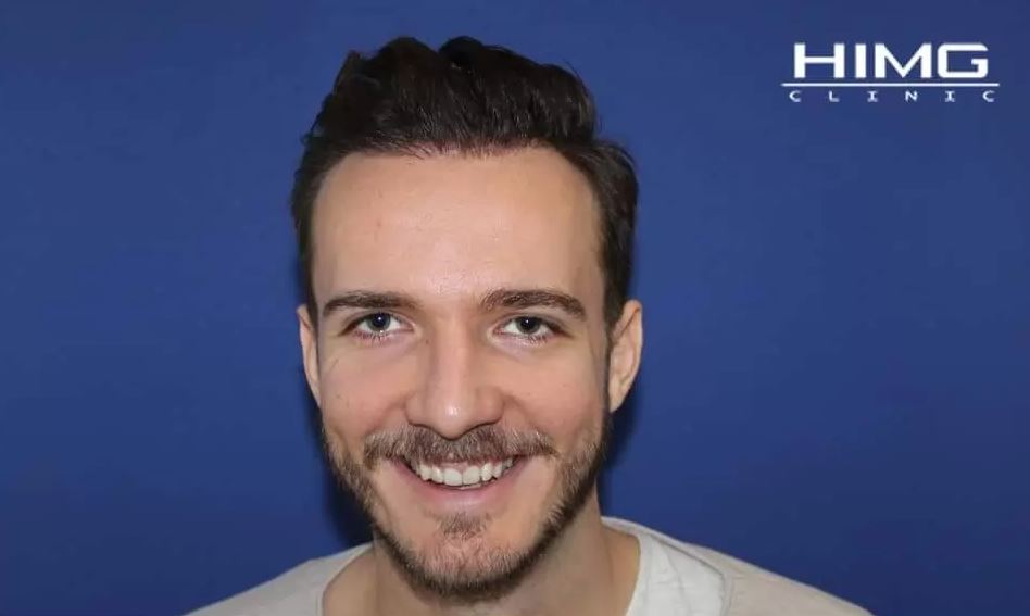 hajbeültetés eredmények