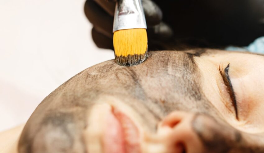 Forradalmi carbon peeling kezelés az Apollon Beauty kozmetikában